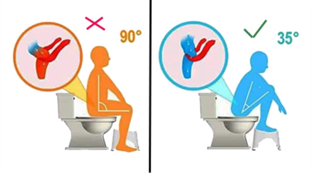 روش صحیح نشستن روی توالت فرنگی